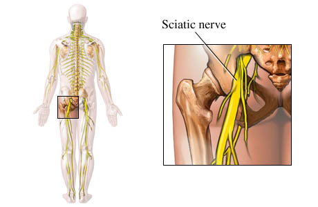 Picture of the sciatic nerve and its location in the body