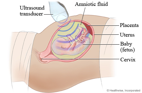 Picture of fetal ultrasound