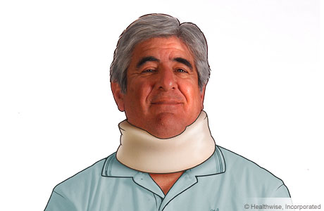 A man wearing a cervical collar