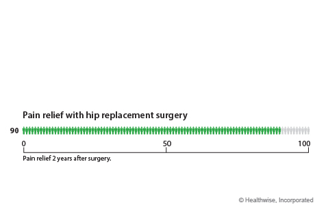 Out of 100 people who have hip replacement surgery, 90 have pain relief within 2 years after surgery.