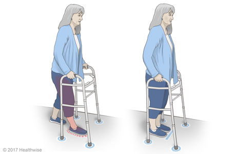 Taking a step with a walker