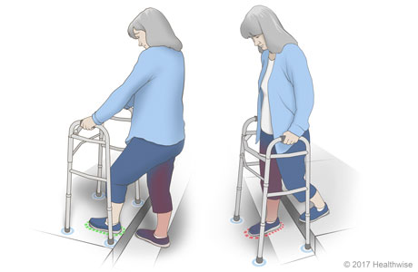 Stepping onto and off of a curb with a walker