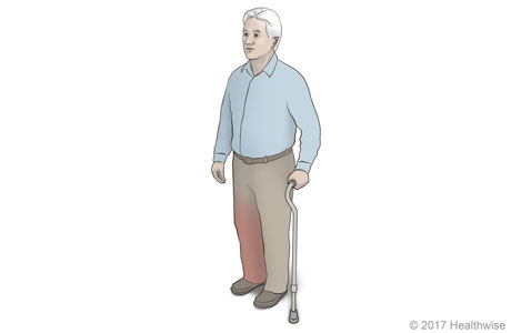 Getting up from a chair with a cane