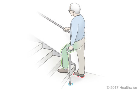 Going up stairs with a cane
