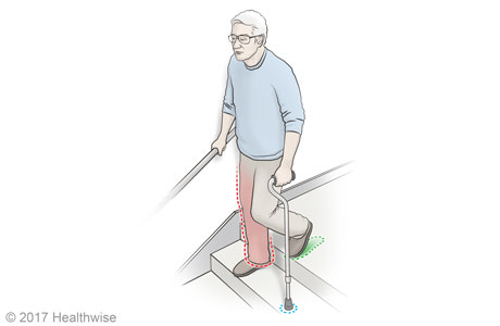 Going down stairs with a cane
