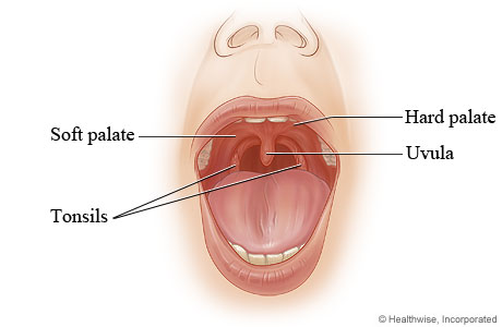 Normal palate