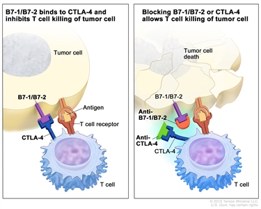 Immune checkpoint inhibitor; the panel on the left shows the binding of proteins B7-1/B7-2 (on the tumor cell) to CTLA-4 (on the T cell), which keeps T cells from killing tumor cells in the body. Also shown are a tumor cell antigen and T cell receptor. The panel on the right shows immune checkpoint inhibitors (anti-B7-1/B7-2 and anti-CTLA-4) blocking the binding of B7-1/B7-2 to CTLA-4, which allows the T cells to kill tumor cells.